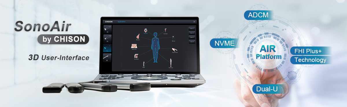 CHISON SonoAir: El sistema de ultrasonido portátil definitivo para diagnósticos seguros y diagnósticos confiables.