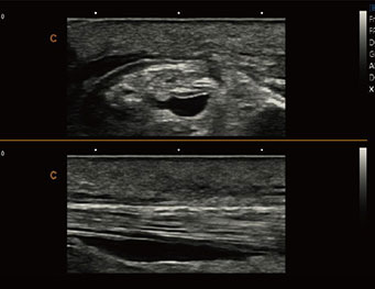 MSK,B Mode