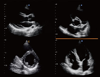 Cardiac, 4B Mode