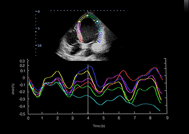 Strain y Strain Rate