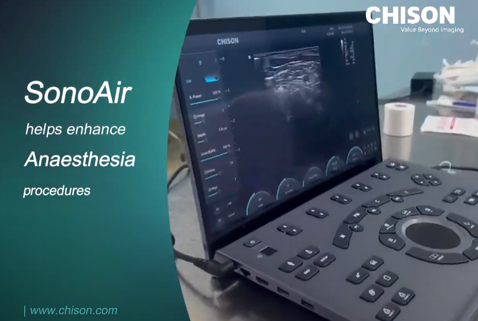 SonoAir in anesthesia